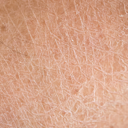 Close-up of dry human skin texture