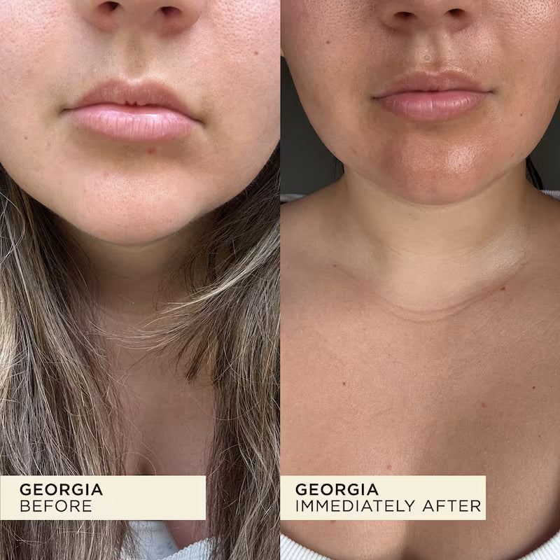Lip and face hydration before and after from using WONDERBALM