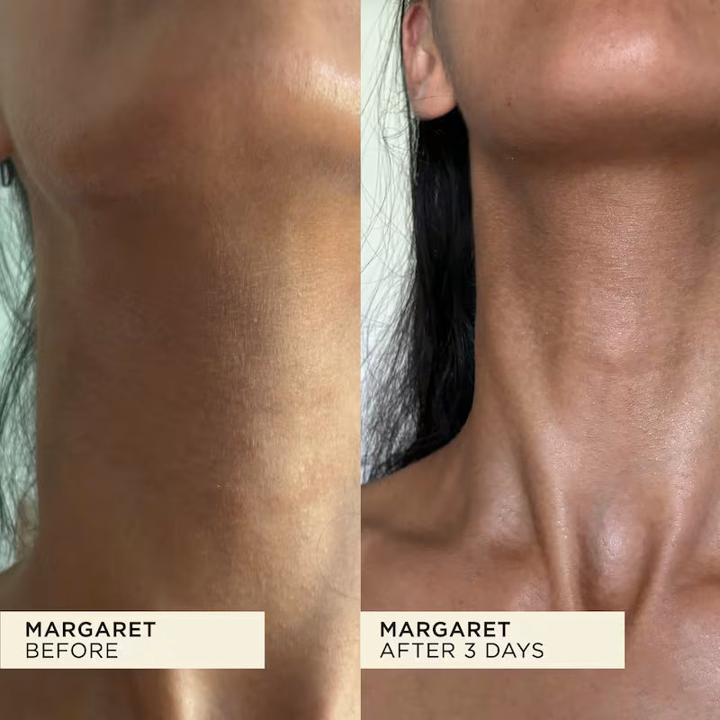 Before and after comparison of skin treatment on a person's neck.