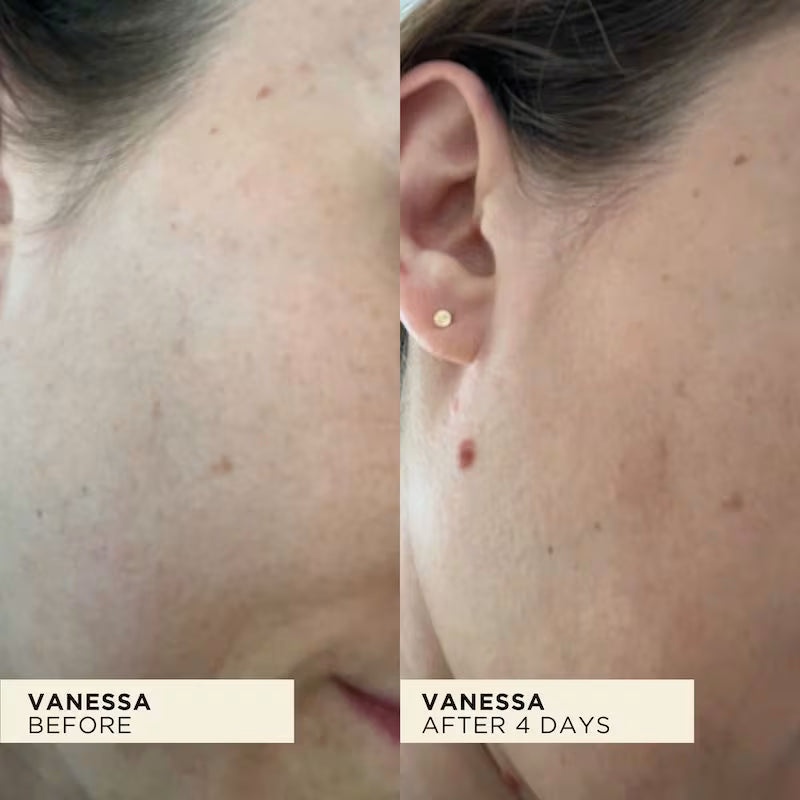 Before and after comparison of WONDERBALM on a person's face.