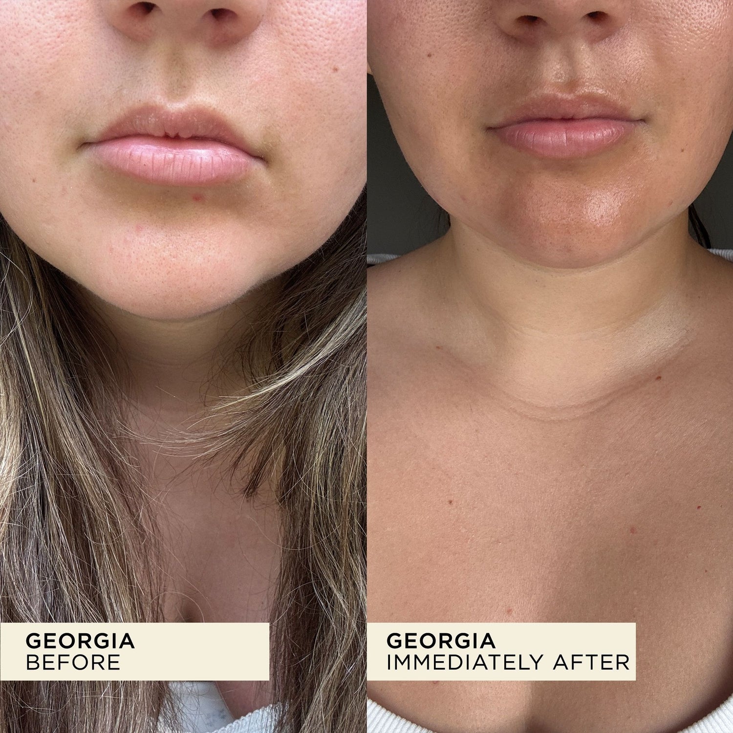 WONDERBALM The Wonder Duo