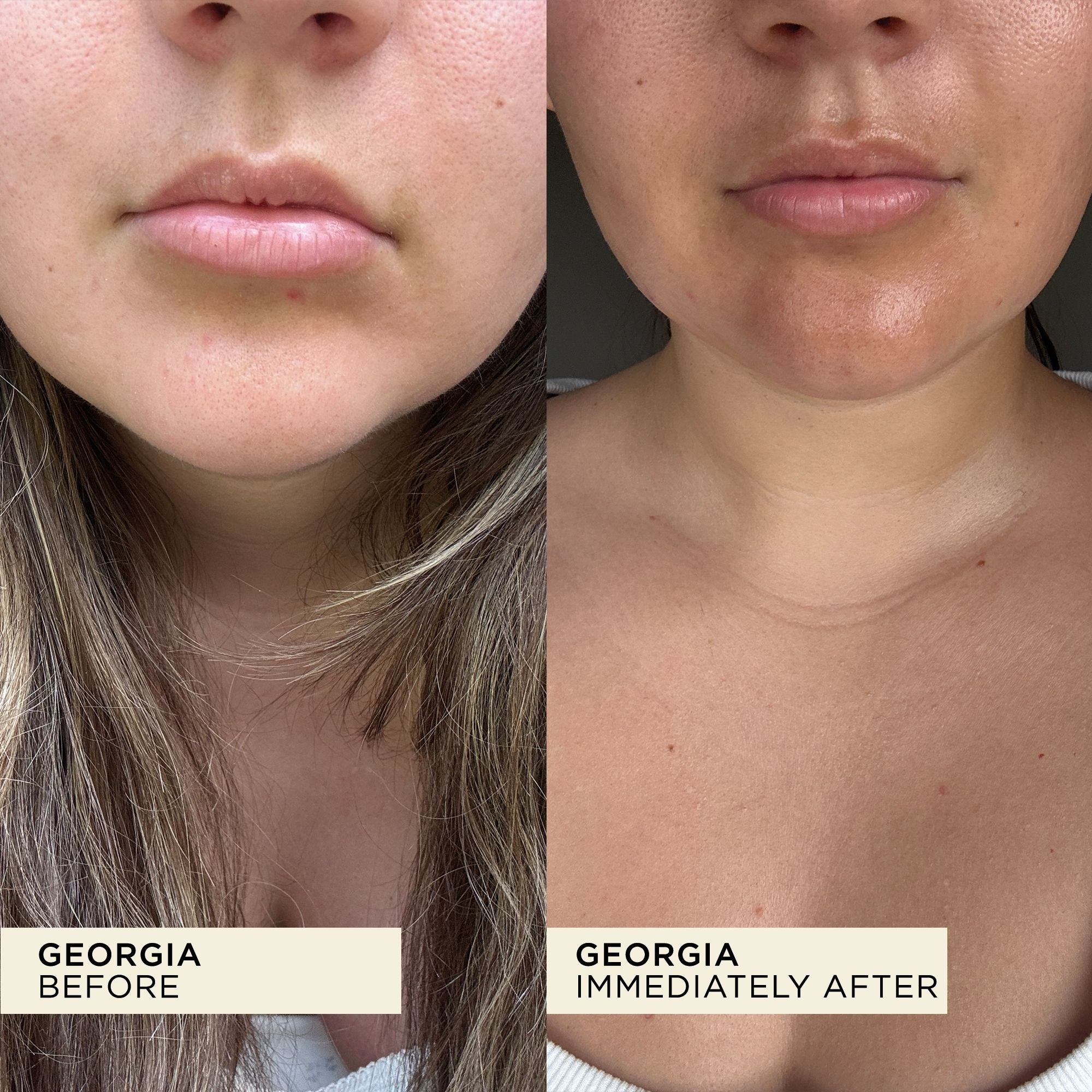 WONDERBALM The Wonder Duo
